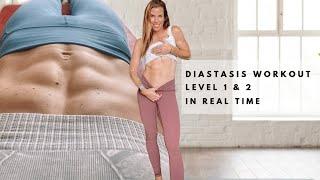 DIASTASIS RECTI EXERCISES TO REPAIR AB SEPARATION | CARLY ROWENA