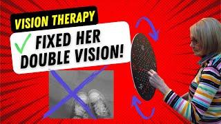 Blurred Vision and Double Vision fixed with Vision Therapy - Levin Eye Care Center