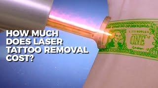 How Much Does Laser Tattoo Removal Cost? | Claudio Explains | Body Details