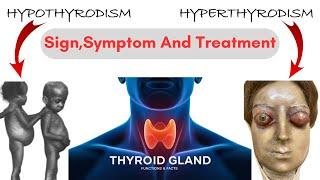 Hypothyroidism vs hyperthyroidism nclex | Hypothyroidism and hypothyroidism difference