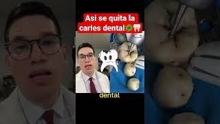 ASÍ SE QUITA LA CARIES DENTAL #shorts