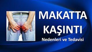 MAKATTA KAŞINTI Nedenleri ve Tedavisi