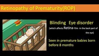 "Retinopathy of Prematurity" awareness video by Dr Anupama Bappal