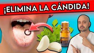 ¡Elimina HONGOS como la CÁNDIDA para SIEMPRE! || 7 REMEDIOS NATURALES