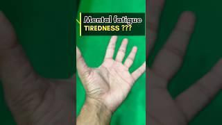 Mudra For Mental Fatigue And Turedness #viralvideo #ytshorts #yoga #shortsvideo #shortsvideo #fit