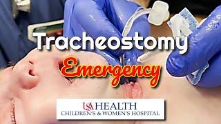 Airway Emergency: A Rapidly Closing Tracheostomy Site