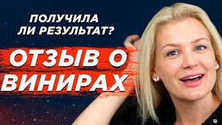 ВИНИРЫ Отзыв. Я ОЖИДАЛА ДРУГОГО..? Виниры для зубов