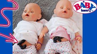 ️Baby Doll Twins' UMBILICAL CORDS?! ‍️ A Call from Dr. Tulip! 