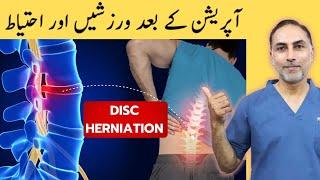 Exercises After Disc Surgery | Exercises And Precautions