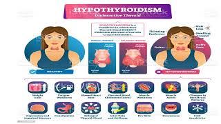 Thyroid Disorders for public awareness (Urdu)