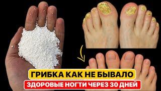 ВСЕГО 15 МИНУТ — и ГРИБОК ИСЧЕЗ! Копеечное средство от грибка ногтей. ГРИБОК УЙДЕТ НАВСЕГДА!