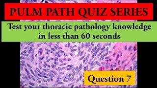 Test your thoracic pathology knowledge in less than 60 seconds. Question 7