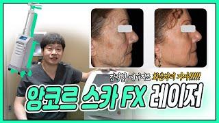 [서면피부과]가장쎄고 가장 깊게 들어가는 레이저 - [앙코르스카FX레이저]