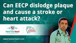 Can EECP dislodge plaque and cause a stroke or heart attack?