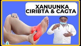 CIRIBTA & CAGTA HOSE XANUNKA KU DHACA WAXA KENA, CALAMADAHA LAGU GARTO & DAWENTODA DR. MAHAMED LIBAN