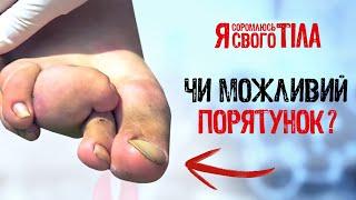 Когда руки не помогают, а мешают – Я соромлюсь свого тіла | ЗДОРОВЬЕ | МЕДИЦИНА | ЛЕЧЕНИЕ