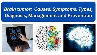 Brain Tumor  - Causes and Risk Factors, Symptoms, Diagnosis Management and Prevention