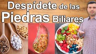 COMO ELIMINAR LAS PIEDRAS EN LA VESICULA ¿SIN OPERACIÓN? - Adiós Calculos Biliares Para Siempre