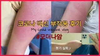 코로나 Vlog. 모더나 백신 부작용 후기 (20대 모더나) | 모더나 1차 2차 3차 접종 후기 | 모더나 부스터샷 부작용