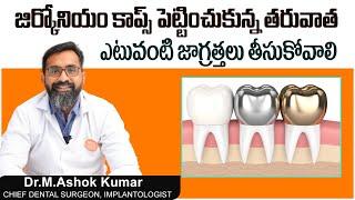 జిర్కోనియం కాప్స్ పెట్టించుకున్న || Before and After Zirconium Crowns || Eledent Dental Hospitals