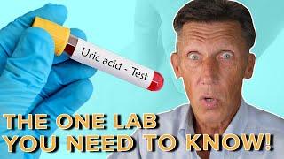 The #1 Lab You need to Know NOW! Uric Acid