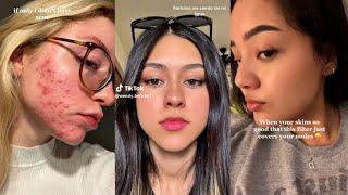 If only I didn't have acne... Clear Skin ~ TikTok Compilation