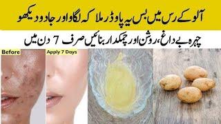 Japanese Secret Get Super fast Brightening Glowing Face pack| skin whitening home remedies