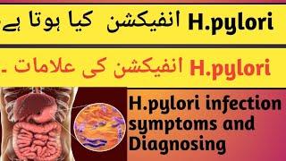 H.pylori infection kia hotha Hy ? H.pylori infection ki Alamaath? symptoms of H.pylori infection