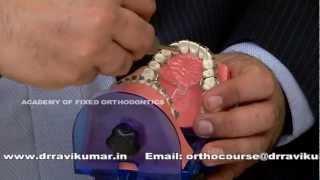 Orthodontic Mini Screw Implant (TAD) Course