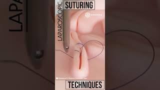 Laparoscopic Suturing Techniques #shorts #tech #suture #training #laparoscopy #medical #medicine