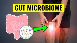 Gut Microbiome: The Truth on How Foods Cause Arthritis