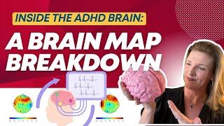 Inside the ADHD Brain: A Brain Map Breakdown