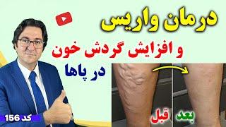 با این نسخه براحتی و بدون جراحی گرفتگی رگ، واریس و درد پا رو درمان کن!