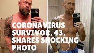 Mike Schultz -   Coronavirus survivor, 43, shares shocking photo showing 50-lb weight loss