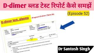 How to Read D dimer test ? Coagulation Test (Episode 52) Dr Santosh Singh