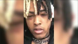 XXXTENTACION talking about depression // How to help someone with depression