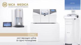 Микропротезирование CEREC (виниры | коронки | вкладки) - керамическая реставрация зубов за 1 визит.