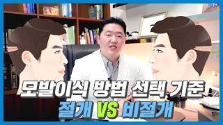 모발이식 절개 비절개 수술방법  선택 기준을 알려드립니다.