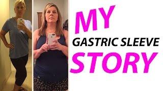 Kim - Gastric Sleeve Before and After Pictures | 2016