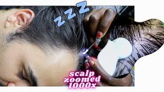 ASMR SUPER ZOOM scalp & lice check extremely satisfying | scratching with a MICROSCOPE