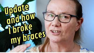 How a cucumber broke my braces! Month 1 braces PROGRESS Update!