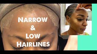 Low Hairline  Application | How to fix Low and narrow hairline problems #boldholdlacetape