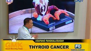 Thyroid Cancer