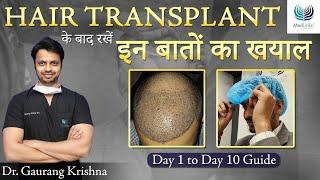 How to Spend the First 10 Days After Hair Transplant? | Precautions after Hair Transplant | Medlinks