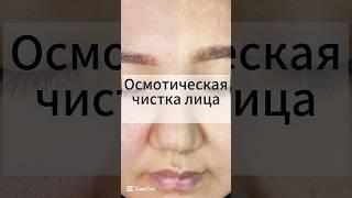 Осмотическая #чисткалица #косметология #skincareroutine #натуральнаякосметика #уходзалицом