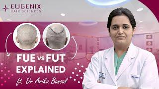 FUE Hair Transplant | FUT vs FUE Hair Transplantation Explained at Eugenix