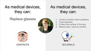 Sclerals vs Contacts