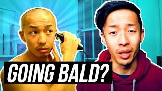 ASIAN GUY GOING BALD? ACCEPTING MY BALDING AND HOW TO GET OVER BALDING