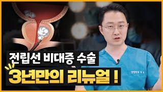 전립선비대증수술! 3년만에 새로운수술 업데이트영상! 워터젯로봇수술? 홀렙수술?