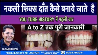 Best dental hospital for dental implant |top dental clinic in India |top dental clinic in jaipur |